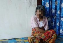 Nenek 47 Tahun di Bombana Derita Tumor Ganas di Wajah, Butuh Uluran Tangan