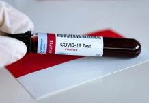 Rapid Test Reaktif, 16 OTG di Buteng Jalani Swab PCR