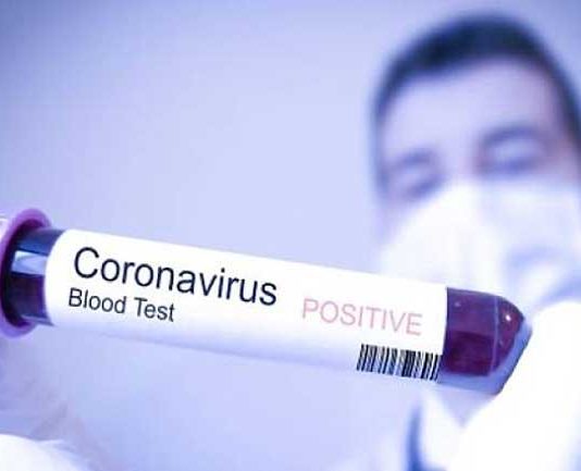 Busel Catat Satu Kasus Baru Positif Covid-19