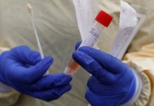 16 Warga Busel Jalani Swab Tes