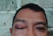 Warga Tomia Diduga Dianiaya Oknum Polisi